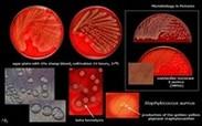 staphylococcus aureus